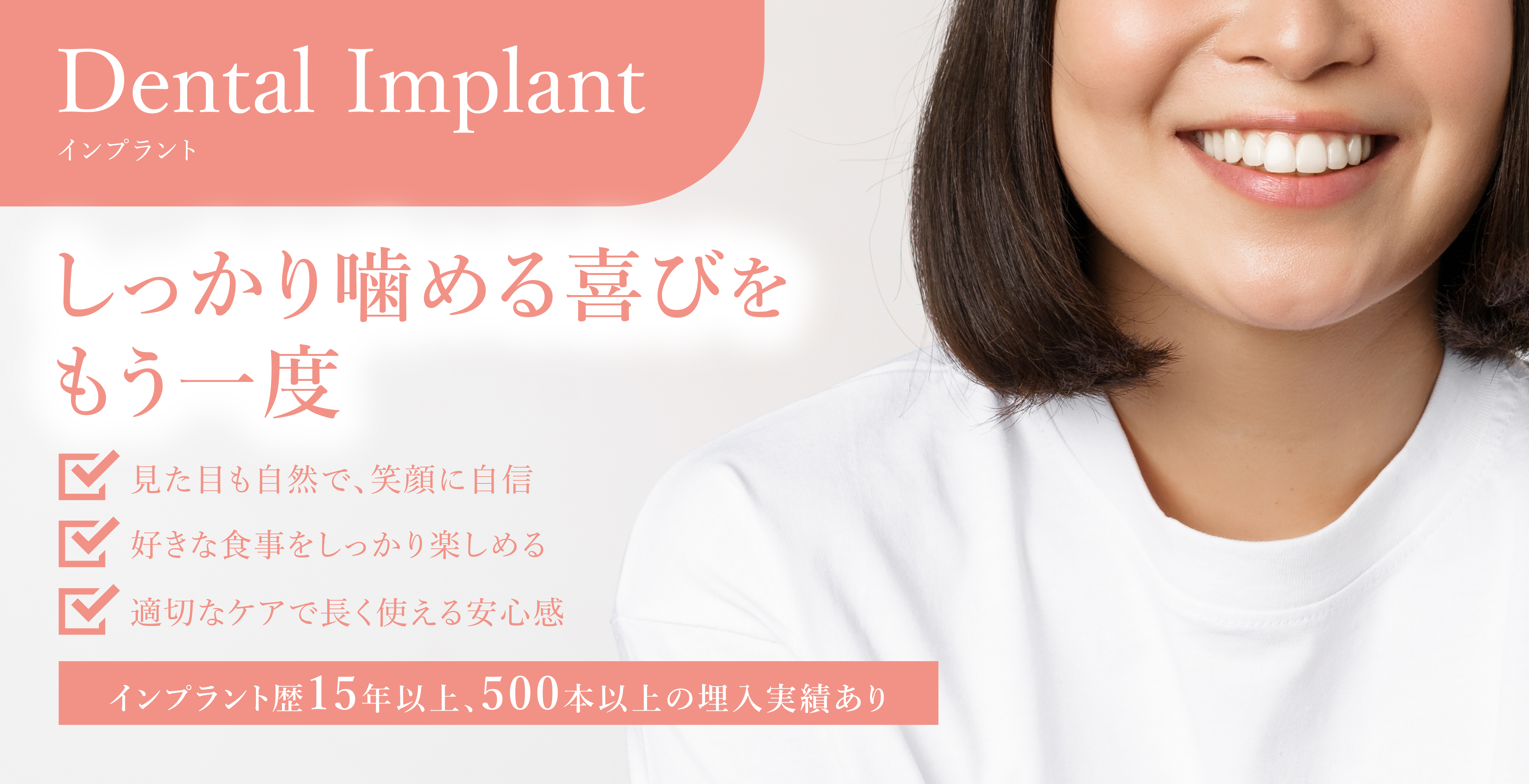 インプラント