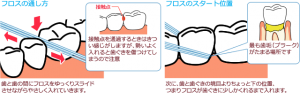 みなさんは歯みがきにどんな道具を使っていますか ハート歯科クリニック いまい