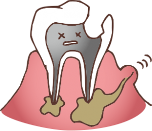 噛む 固い 歯 痛い もの が と を 硬いものを噛むと歯は丈夫になるの？